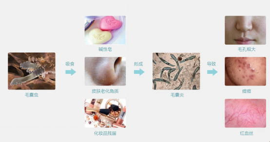 護(hù)膚小常識(shí)(1)-陳艷麗化妝品-董煥181